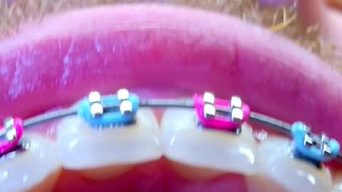 JUAN  JUAN online show from 15, 2, 2026